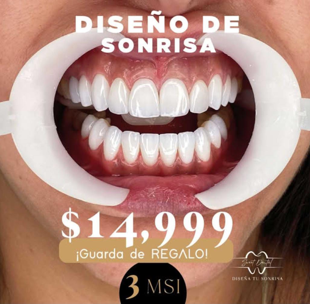 Sweet Dental Alta Estética Dental